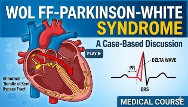 Wolf Parkinsons White Syndrome : A case Based Discussion